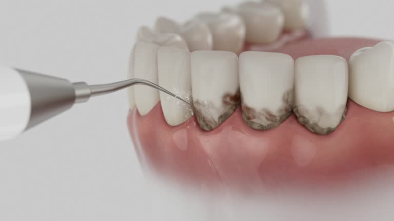 Reliable Dental contractor in Umatilla, FL by Smile Center Dentistry